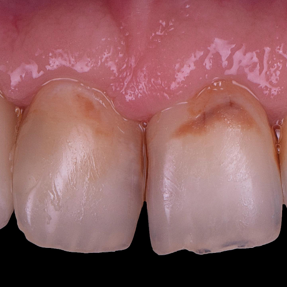 Фотографии события