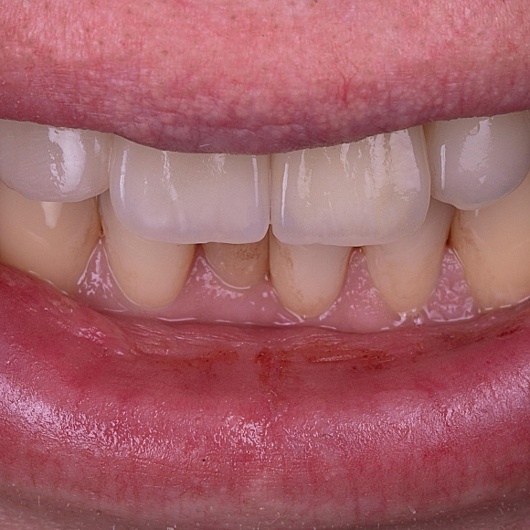 Фотографии события