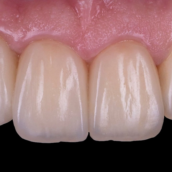 Фотографии события